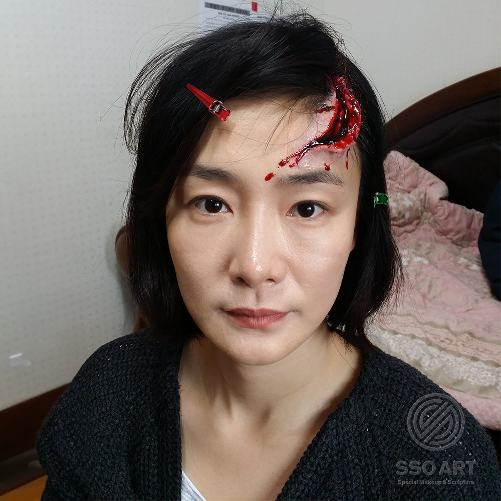 이마 상처분장