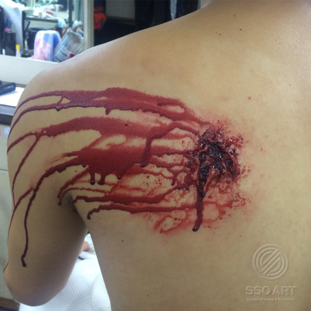 총상 상처분장