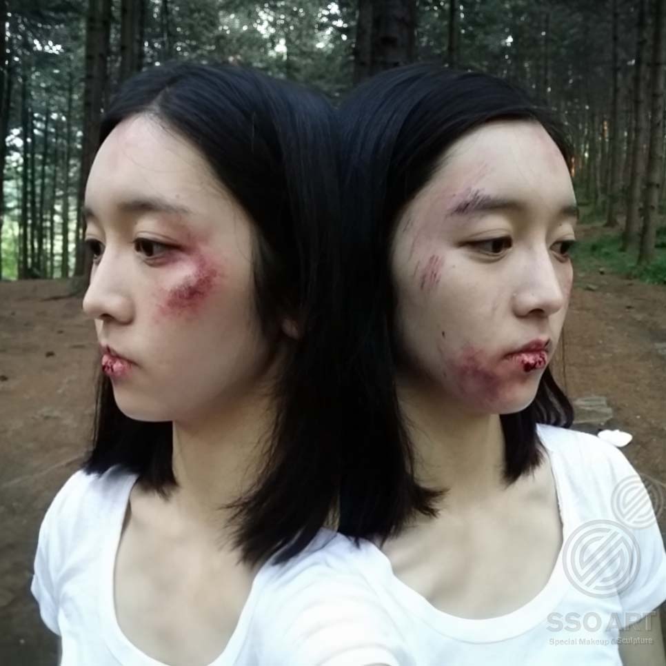 상처분장
