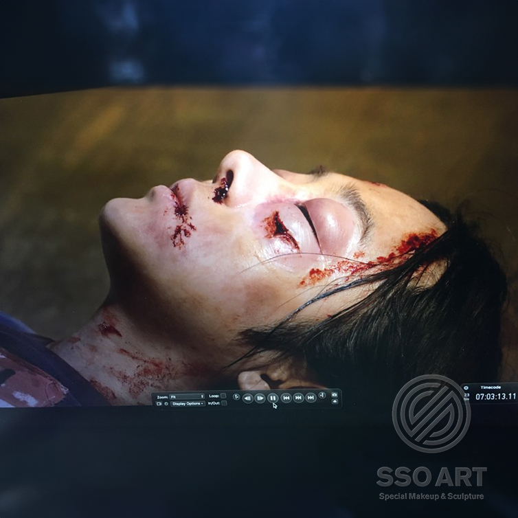 부은 눈 & 상처분장
